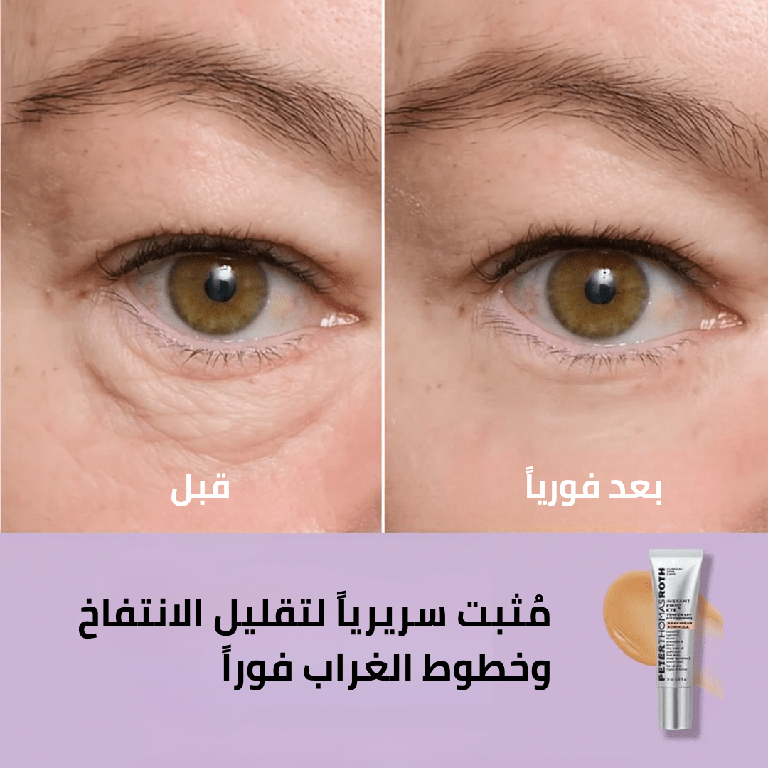 كريم شد العيون سر الجمال الشاب الذي يعيد لكِ إشراقة الثقة والحيوية