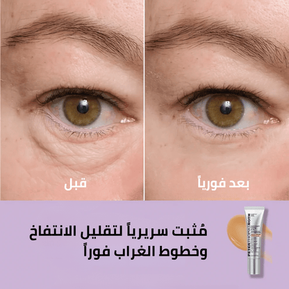 كريم شد العيون سر الجمال الشاب الذي يعيد لكِ إشراقة الثقة والحيوية