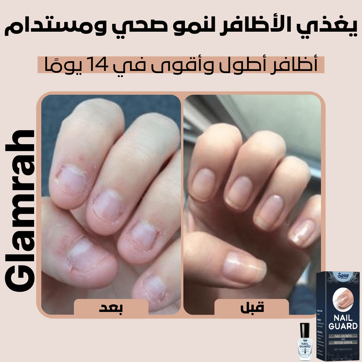 سيروم كيرا لنمو وإصلاح الأظافر التالفة – السر لعناية فائقة بالأظافر