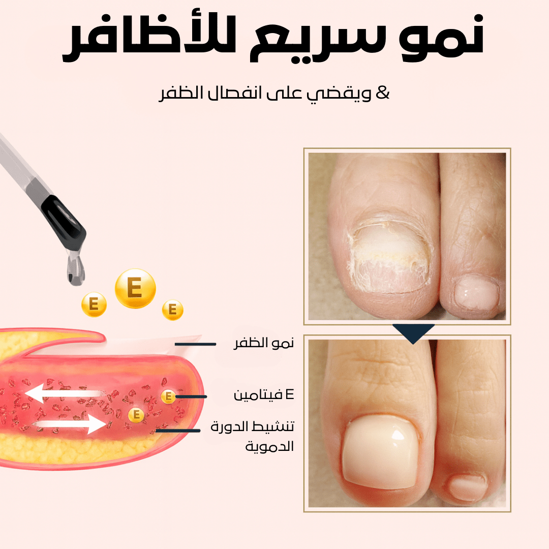 سيروم كيرا لنمو وإصلاح الأظافر التالفة – السر لعناية فائقة بالأظافر