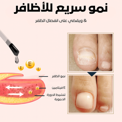 سيروم كيرا لنمو وإصلاح الأظافر التالفة – السر لعناية فائقة بالأظافر