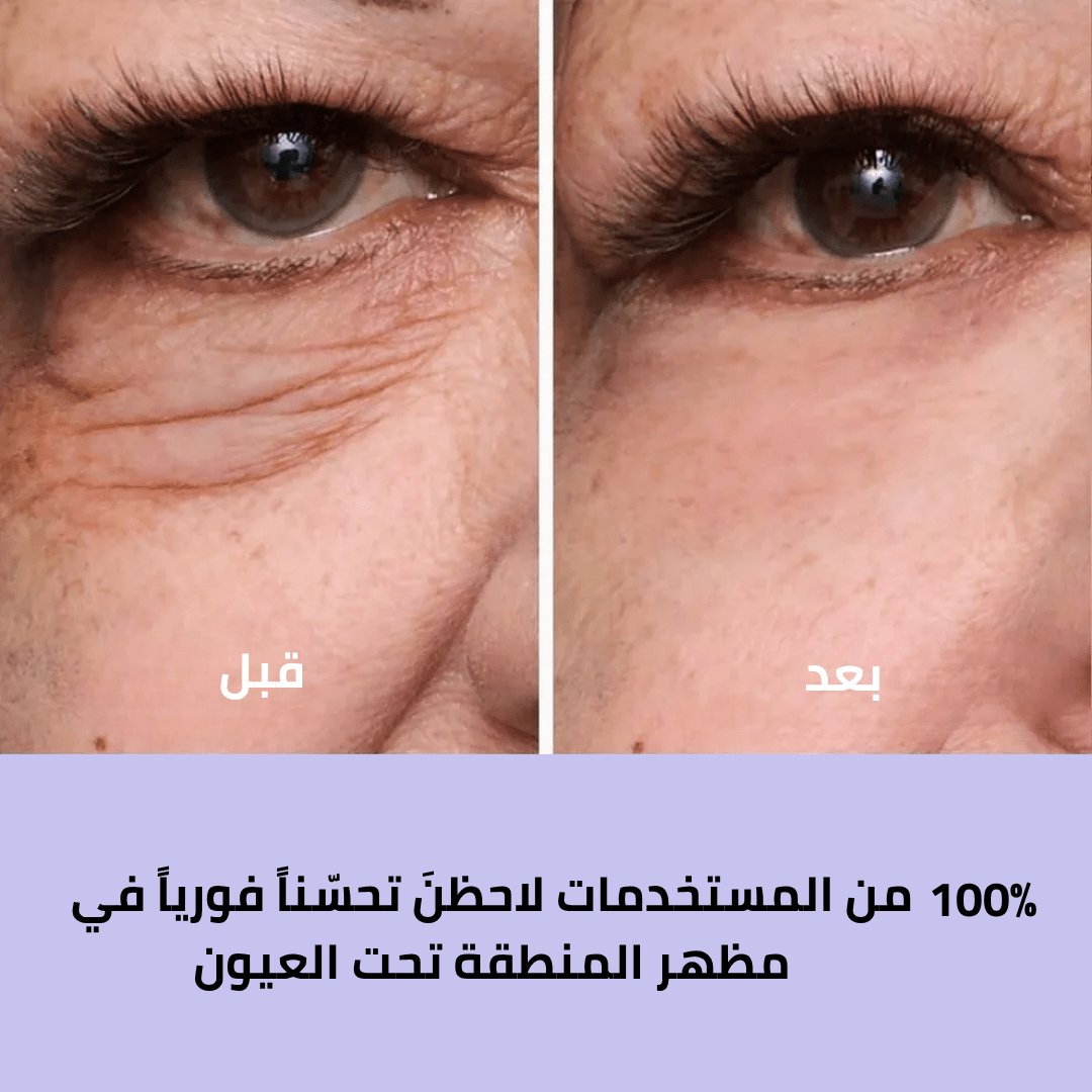 كريم شد العيون سر الجمال الشاب الذي يعيد لكِ إشراقة الثقة والحيوية