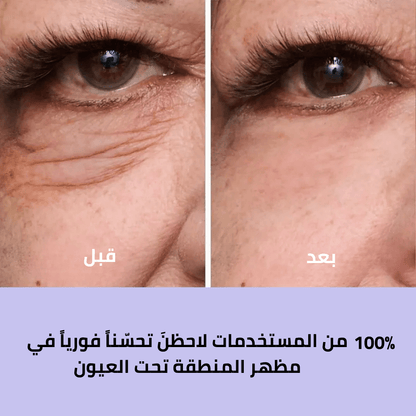 كريم شد العيون سر الجمال الشاب الذي يعيد لكِ إشراقة الثقة والحيوية